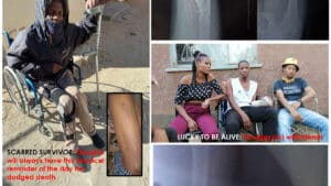 Life on one leg